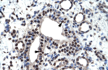 ZNF499 Rabbit Polyclonal Antibody