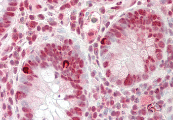 RIOX2 Rabbit Polyclonal Antibody