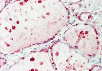 RIOX2 Rabbit Polyclonal Antibody