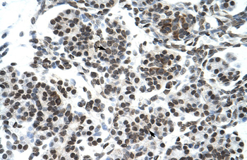 ZNF394 Rabbit Polyclonal Antibody
