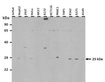 MIXL1 Rabbit Polyclonal Antibody