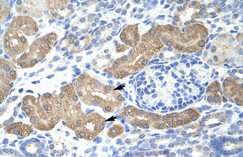 L3MBTL2 Rabbit Polyclonal Antibody