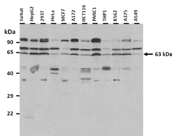 TCF7L1 Rabbit Polyclonal Antibody