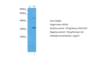 GFI1B Rabbit Polyclonal Antibody