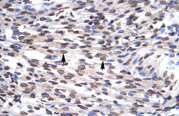GFI1B Rabbit Polyclonal Antibody
