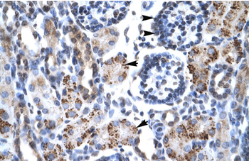GFI1B Rabbit Polyclonal Antibody
