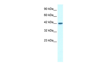 GFI1B Rabbit Polyclonal Antibody
