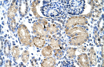 ELL Rabbit Polyclonal Antibody