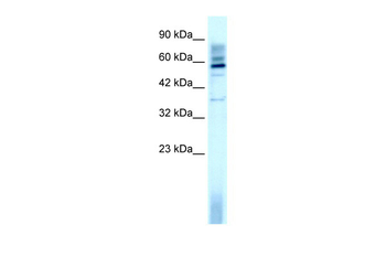 TAF15 Rabbit Polyclonal Antibody