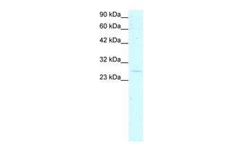 YEATS4 Rabbit Polyclonal Antibody