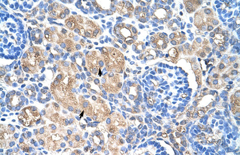 HSPB1 Rabbit Polyclonal Antibody
