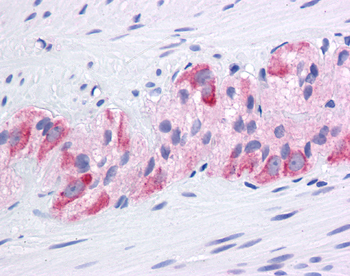 HSP90AA1 Rabbit Polyclonal Antibody
