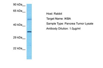 NFKBIA Rabbit Polyclonal Antibody