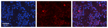 TP53 Rabbit Polyclonal Antibody