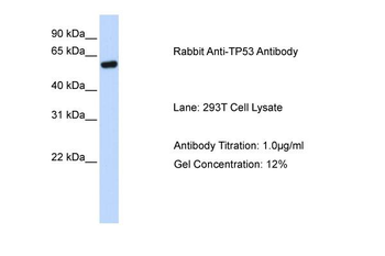 TP53 Rabbit Polyclonal Antibody