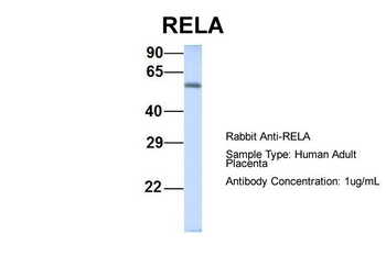 RELA Rabbit Polyclonal Antibody