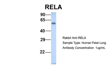 RELA Rabbit Polyclonal Antibody