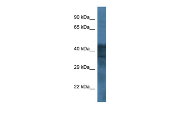 GABRB1 Rabbit Polyclonal Antibody