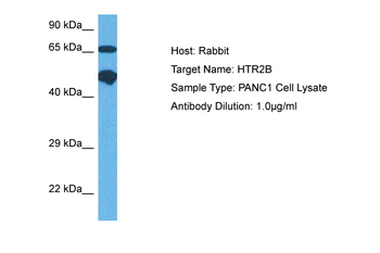 HTR2B Rabbit Polyclonal Antibody