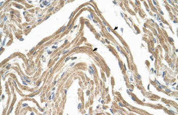 CCBP2 Rabbit Polyclonal Antibody