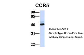 CCR5 Rabbit Polyclonal Antibody