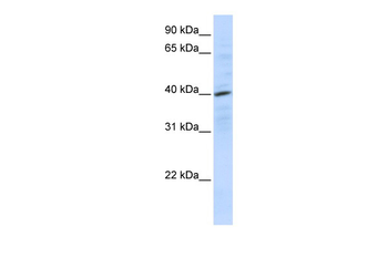 CXCR4 Rabbit Polyclonal Antibody