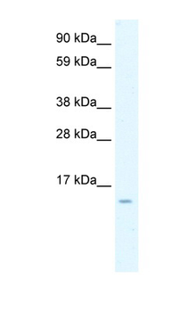 CCL7 Rabbit Polyclonal Antibody