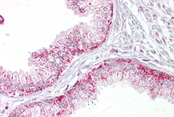 AURKA Rabbit Polyclonal Antibody