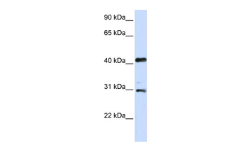 AURKA Rabbit Polyclonal Antibody