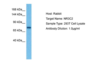 NR3C2 Rabbit Polyclonal Antibody
