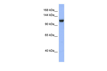 NR3C2 Rabbit Polyclonal Antibody