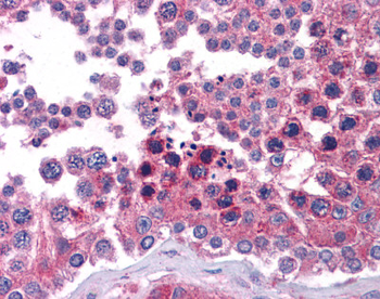 STAT6 Rabbit Polyclonal Antibody