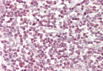 TFCP2 Rabbit Polyclonal Antibody