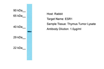 ESR1 Rabbit Polyclonal Antibody
