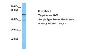 HSF2 Rabbit Polyclonal Antibody
