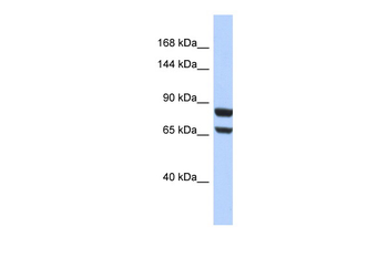 PGR Rabbit Polyclonal Antibody