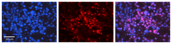Gabpa Rabbit Polyclonal Antibody