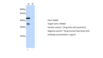 HOXB3 Rabbit Polyclonal Antibody