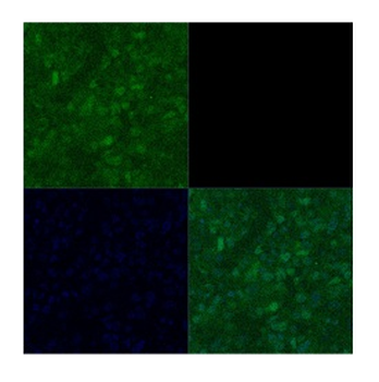 POU3F2 Rabbit Polyclonal Antibody