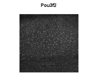 POU3F2 Rabbit Polyclonal Antibody
