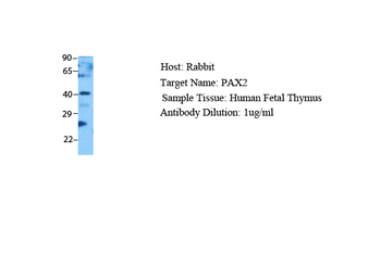 PAX2 Rabbit Polyclonal Antibody
