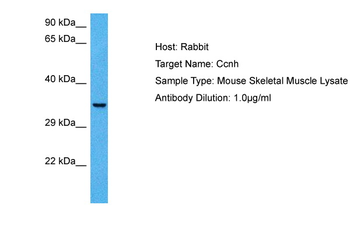 CCNH Rabbit Polyclonal Antibody