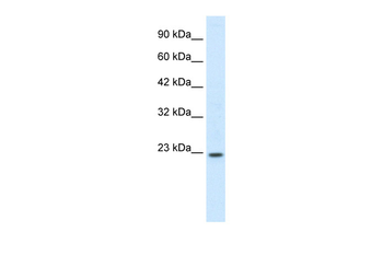 HOXB6 Rabbit Polyclonal Antibody