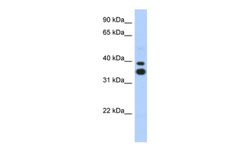 MSX2 Rabbit Polyclonal Antibody