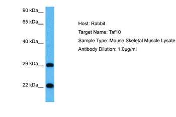 TAF10 Rabbit Polyclonal Antibody