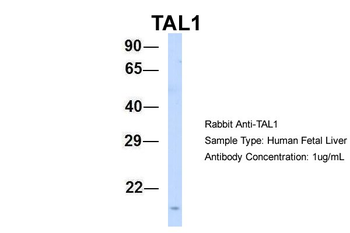 TAL1 Rabbit Polyclonal Antibody