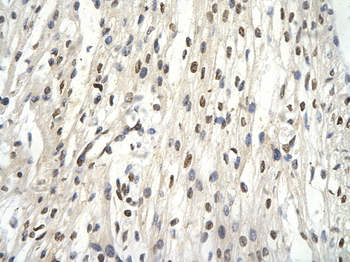GTF2E2 Rabbit Polyclonal Antibody