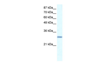 GTF2E2 Rabbit Polyclonal Antibody
