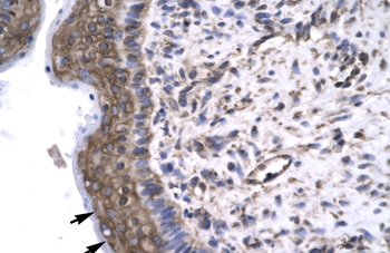 GTF2F2 Rabbit Polyclonal Antibody