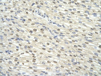 GTF2H3 Rabbit Polyclonal Antibody